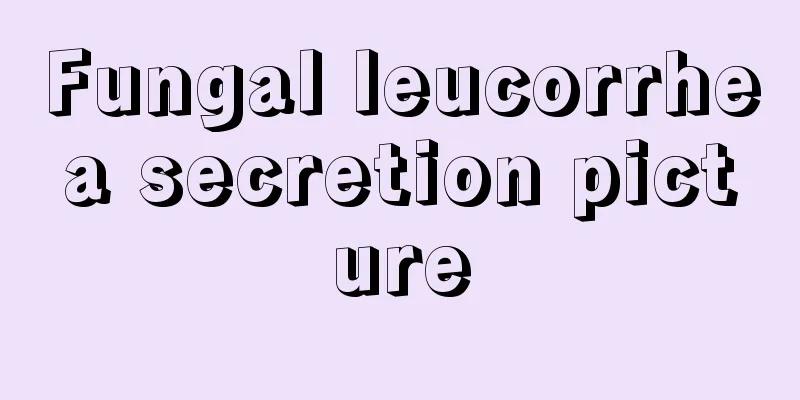 Fungal leucorrhea secretion picture