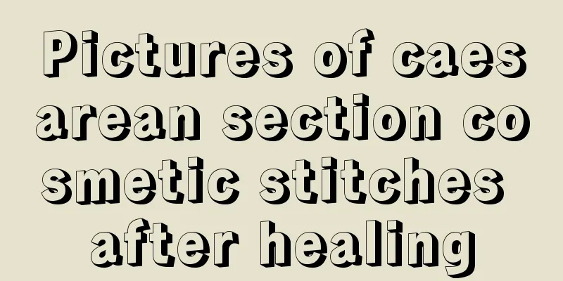 Pictures of caesarean section cosmetic stitches after healing