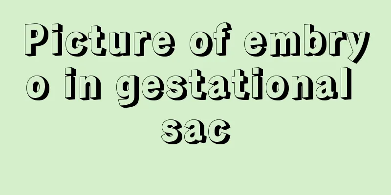 Picture of embryo in gestational sac