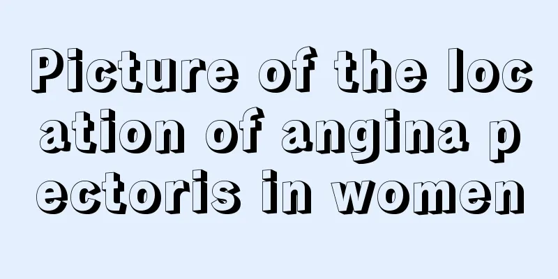 Picture of the location of angina pectoris in women