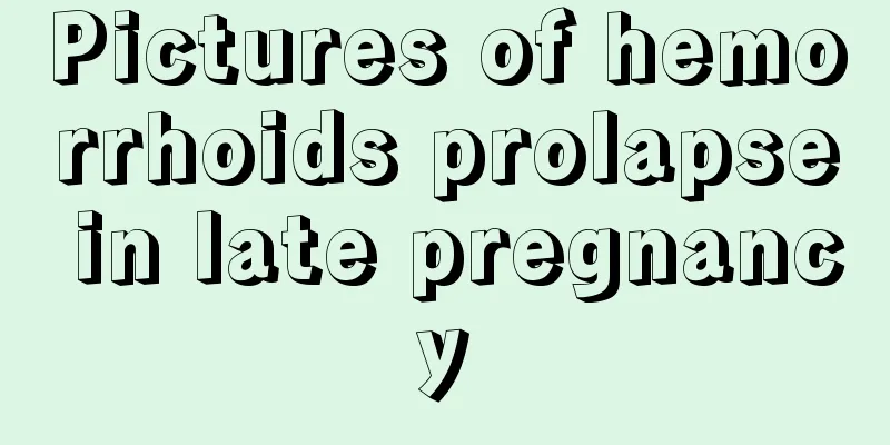 Pictures of hemorrhoids prolapse in late pregnancy