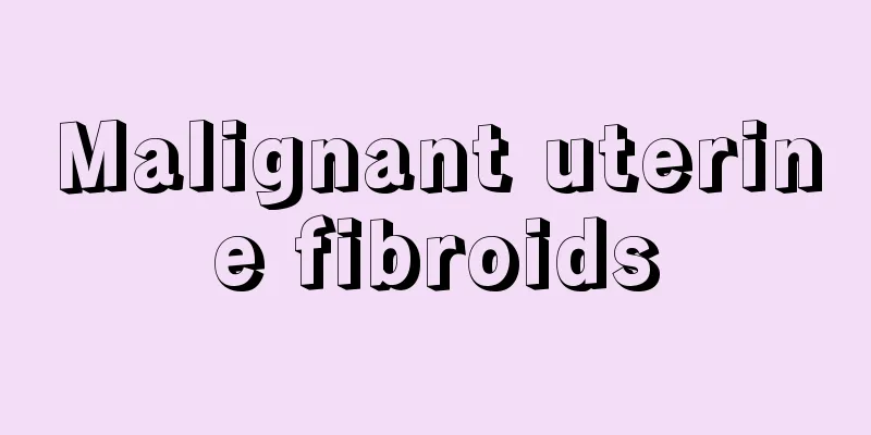 Malignant uterine fibroids