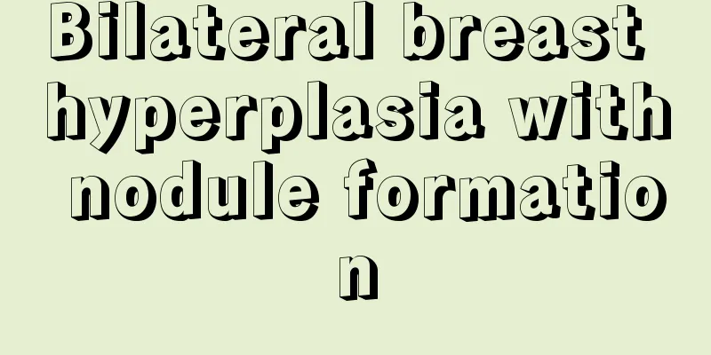 Bilateral breast hyperplasia with nodule formation