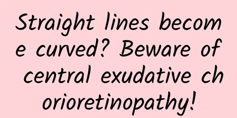 Straight lines become curved? Beware of central exudative chorioretinopathy!
