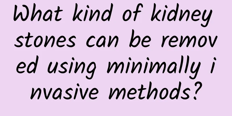 What kind of kidney stones can be removed using minimally invasive methods?