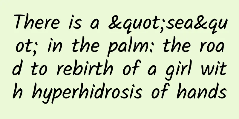 There is a "sea" in the palm: the road to rebirth of a girl with hyperhidrosis of hands