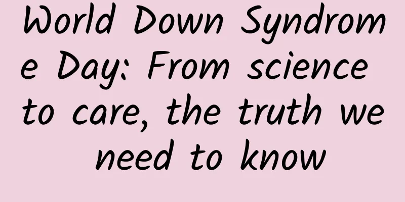 World Down Syndrome Day: From science to care, the truth we need to know