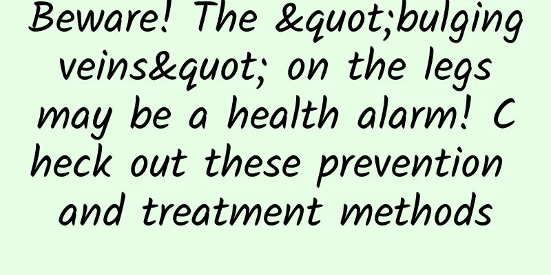 Beware! The "bulging veins" on the legs may be a health alarm! Check out these prevention and treatment methods