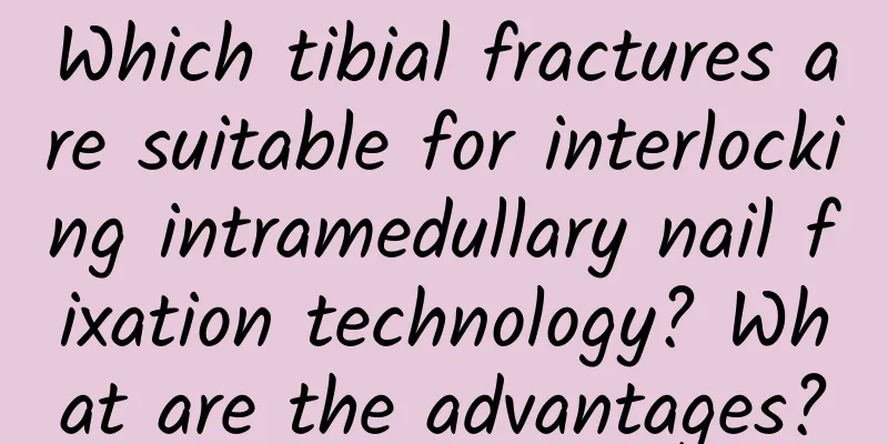 Which tibial fractures are suitable for interlocking intramedullary nail fixation technology? What are the advantages?