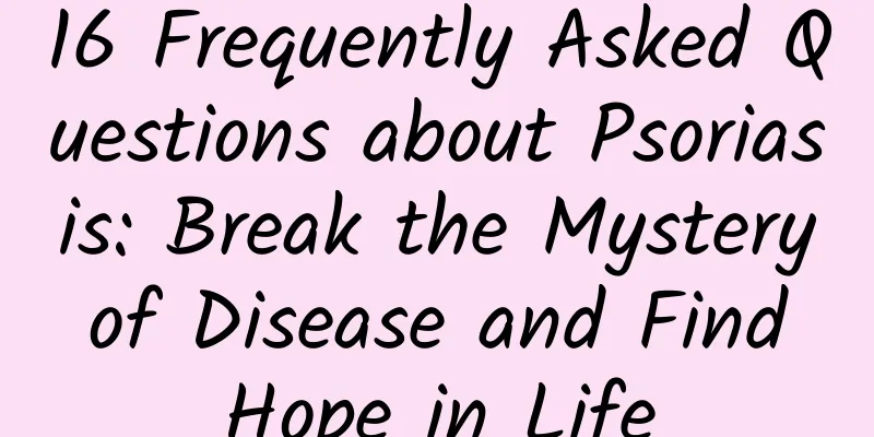 16 Frequently Asked Questions about Psoriasis: Break the Mystery of Disease and Find Hope in Life