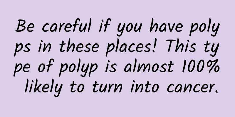 Be careful if you have polyps in these places! This type of polyp is almost 100% likely to turn into cancer.