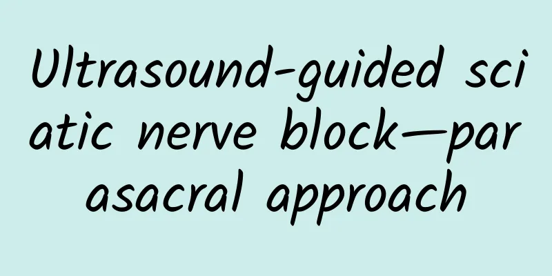 Ultrasound-guided sciatic nerve block—parasacral approach