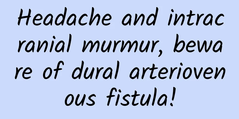 Headache and intracranial murmur, beware of dural arteriovenous fistula!