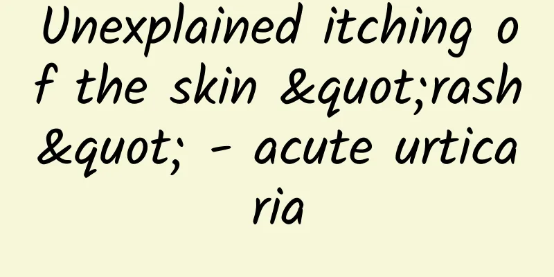 Unexplained itching of the skin "rash" - acute urticaria