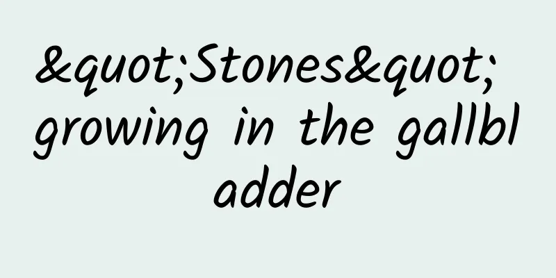 "Stones" growing in the gallbladder