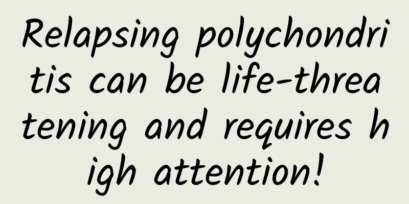 Relapsing polychondritis can be life-threatening and requires high attention!