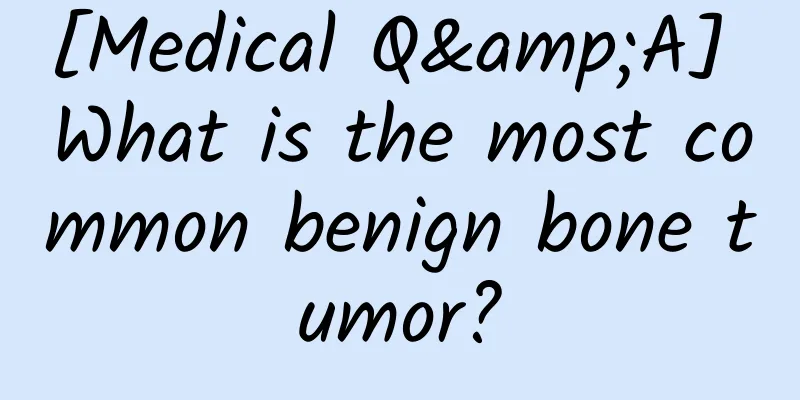 [Medical Q&A] What is the most common benign bone tumor?