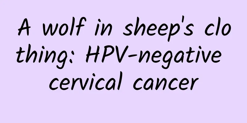 A wolf in sheep's clothing: HPV-negative cervical cancer