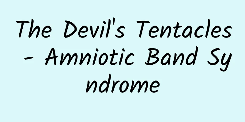 The Devil's Tentacles - Amniotic Band Syndrome