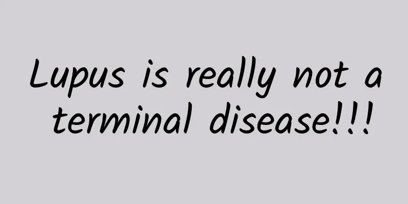 Lupus is really not a terminal disease!!!