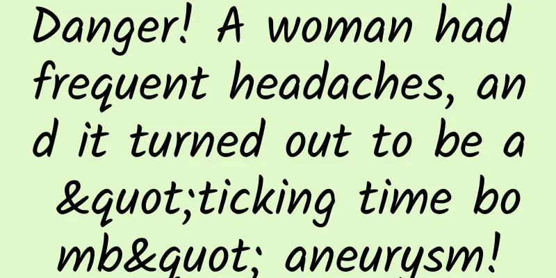 Danger! A woman had frequent headaches, and it turned out to be a "ticking time bomb" aneurysm!