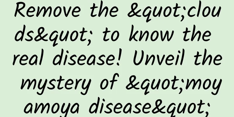 Remove the "clouds" to know the real disease! Unveil the mystery of "moyamoya disease"