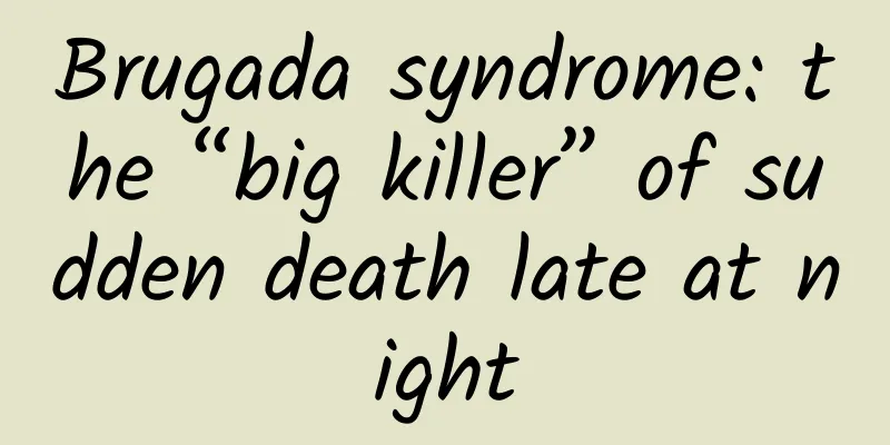Brugada syndrome: the “big killer” of sudden death late at night