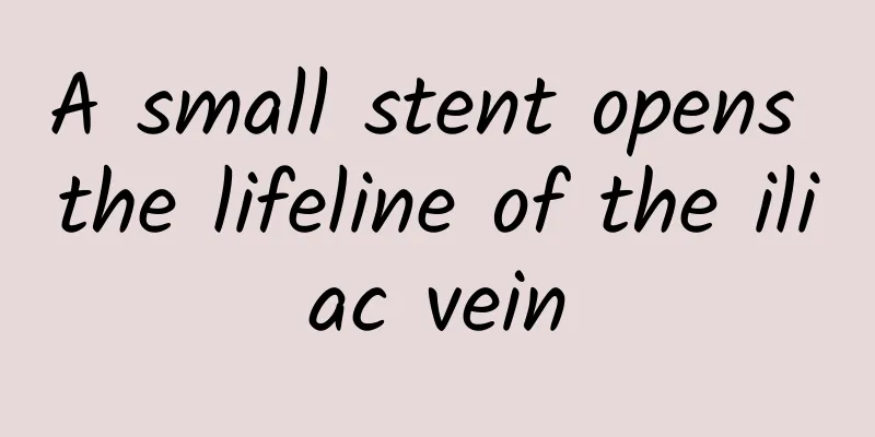 A small stent opens the lifeline of the iliac vein