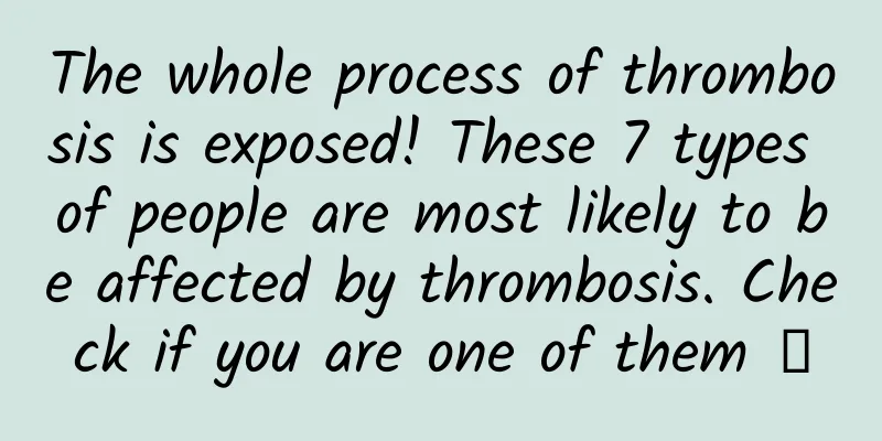 The whole process of thrombosis is exposed! These 7 types of people are most likely to be affected by thrombosis. Check if you are one of them →