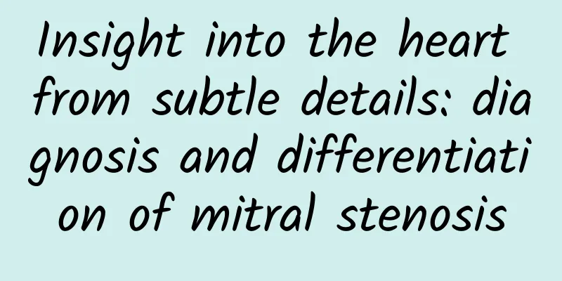 Insight into the heart from subtle details: diagnosis and differentiation of mitral stenosis