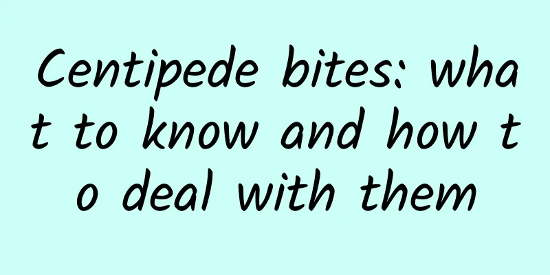 Centipede bites: what to know and how to deal with them