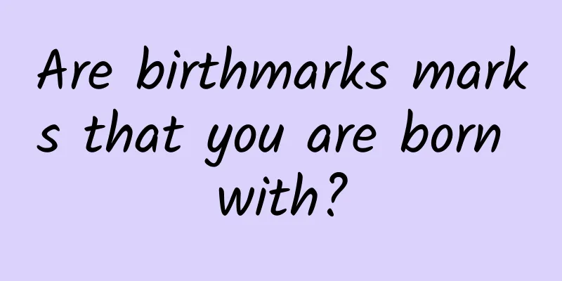 Are birthmarks marks that you are born with?