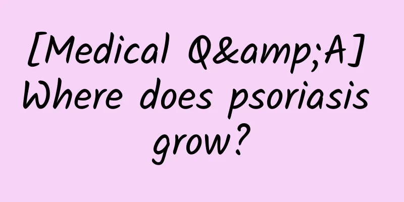 [Medical Q&A] Where does psoriasis grow?