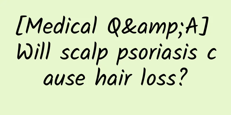 [Medical Q&A] Will scalp psoriasis cause hair loss?