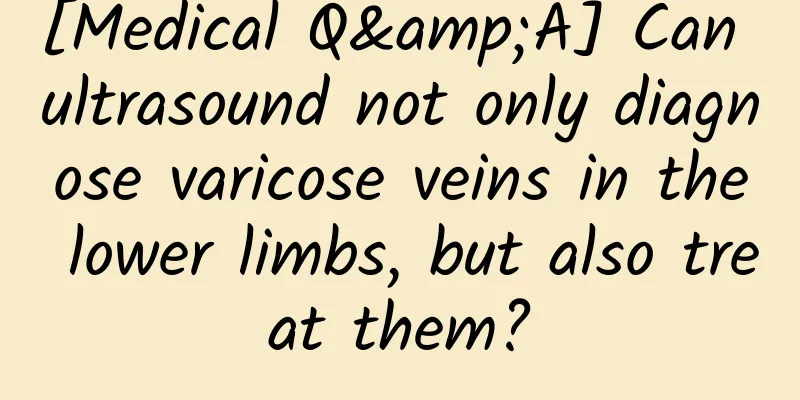 [Medical Q&A] Can ultrasound not only diagnose varicose veins in the lower limbs, but also treat them?