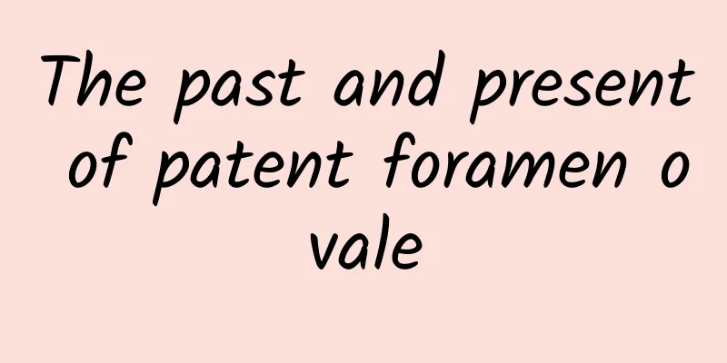 The past and present of patent foramen ovale