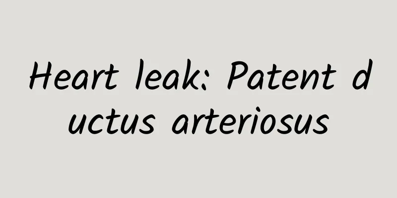 Heart leak: Patent ductus arteriosus