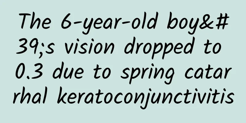 The 6-year-old boy's vision dropped to 0.3 due to spring catarrhal keratoconjunctivitis