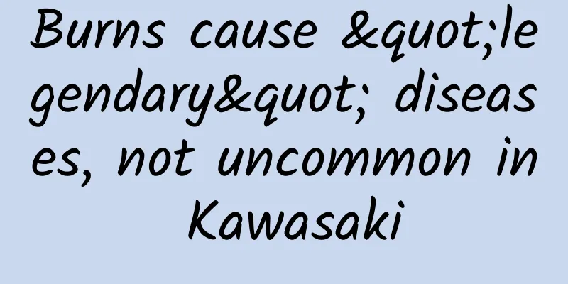 Burns cause "legendary" diseases, not uncommon in Kawasaki