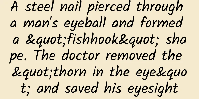 A steel nail pierced through a man's eyeball and formed a "fishhook" shape. The doctor removed the "thorn in the eye" and saved his eyesight