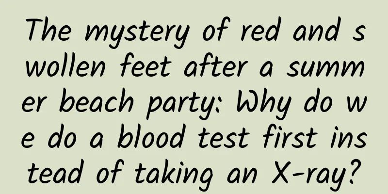 The mystery of red and swollen feet after a summer beach party: Why do we do a blood test first instead of taking an X-ray?
