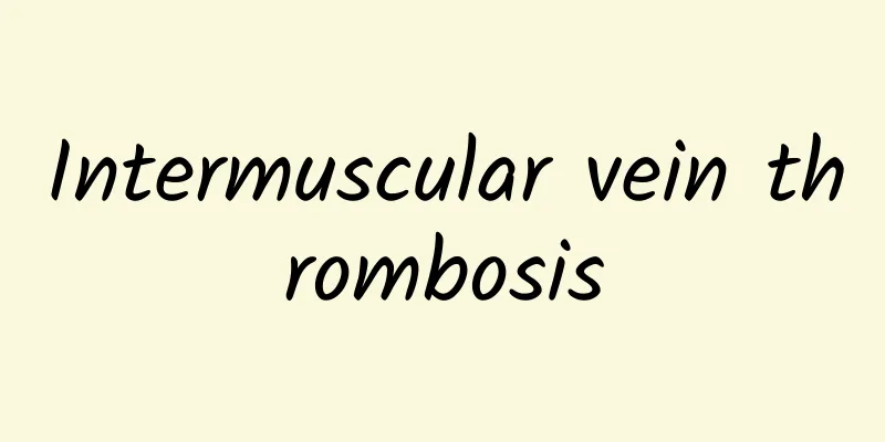 Intermuscular vein thrombosis