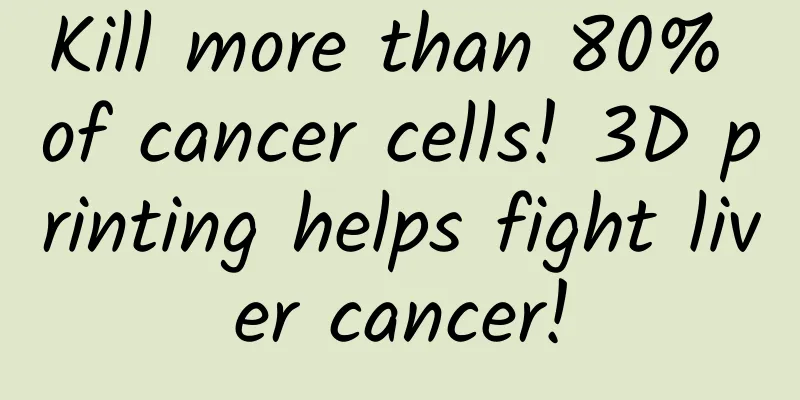 Kill more than 80% of cancer cells! 3D printing helps fight liver cancer!