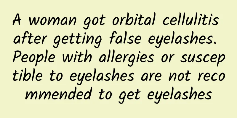A woman got orbital cellulitis after getting false eyelashes. People with allergies or susceptible to eyelashes are not recommended to get eyelashes