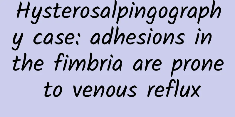 Hysterosalpingography case: adhesions in the fimbria are prone to venous reflux