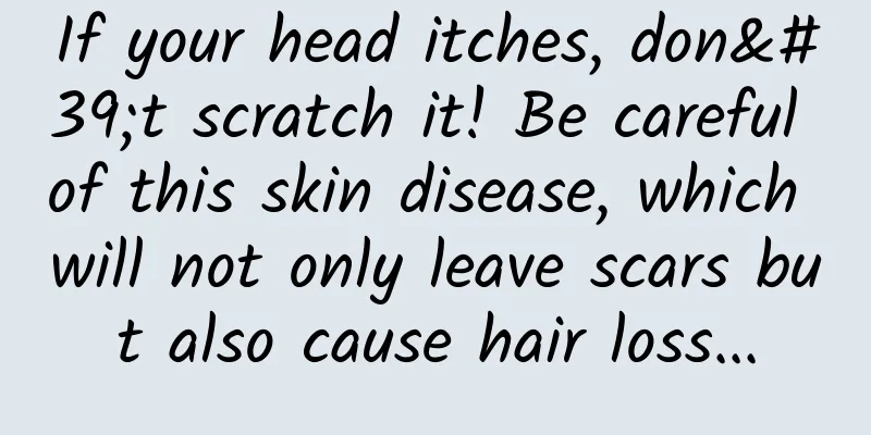 If your head itches, don't scratch it! Be careful of this skin disease, which will not only leave scars but also cause hair loss...