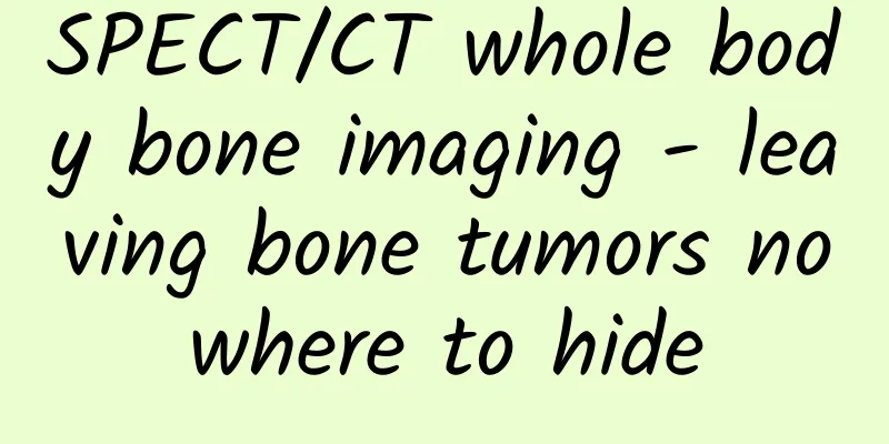 SPECT/CT whole body bone imaging - leaving bone tumors nowhere to hide
