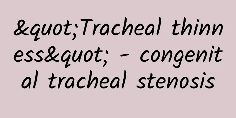 "Tracheal thinness" - congenital tracheal stenosis