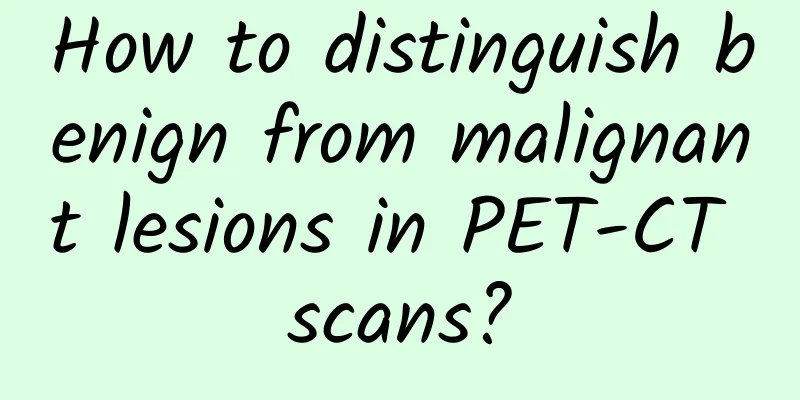 How to distinguish benign from malignant lesions in PET-CT scans?