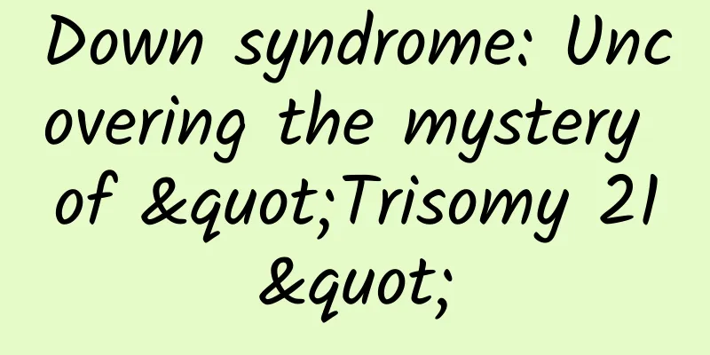 Down syndrome: Uncovering the mystery of "Trisomy 21"